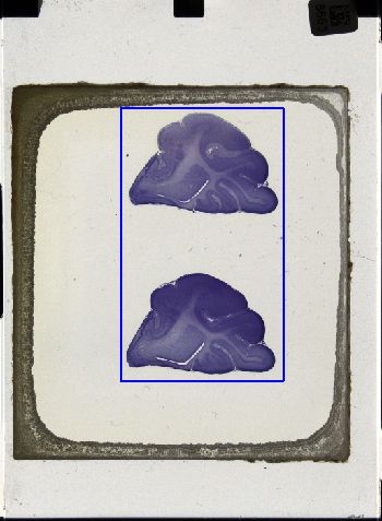 Media type: image; Special Collections 3043   shows specimen_part histological serial section;